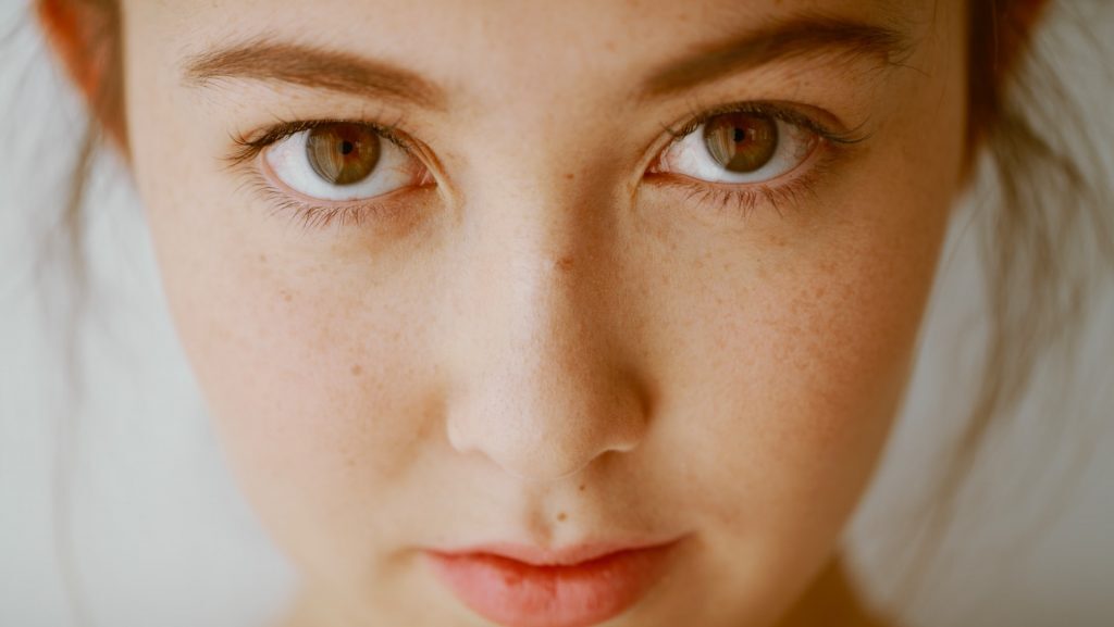 Can the Right Diet Get Rid of Acne? Kelly Bejelly close up of womans face