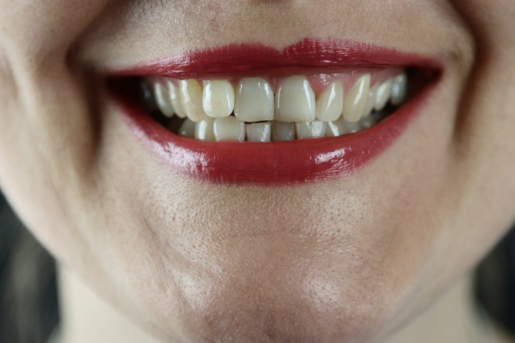 Wisdom Teeth: How They Can Affect Overall Health and Mental Wellbeing Kelly Bejelly Living a healthy lifestyle involves being mindful of what is put into the body and how this affects overall functioning. However nice it is for life to go smoothly, things are not always this simple and when the body throws some complications into the mix, having all the available information at hand is essential for making the right health decisions.